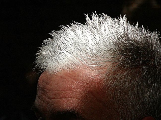 Capelli bianchi prima dei 30 anni? Ecco perché accade