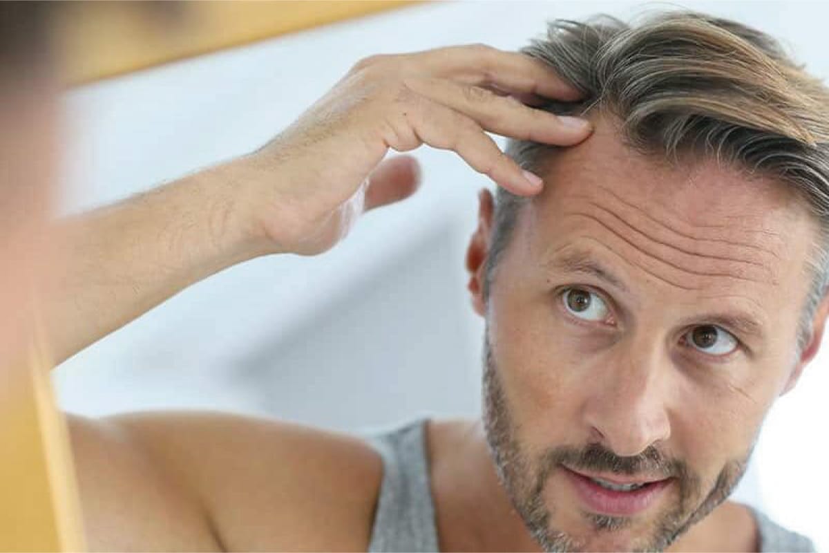 Alopecia seborroica, quali sono i rimedi che funzionano?